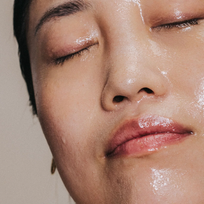 La Brume Systémique